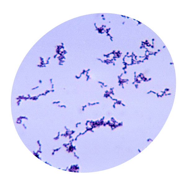 Propionibacterium acnes